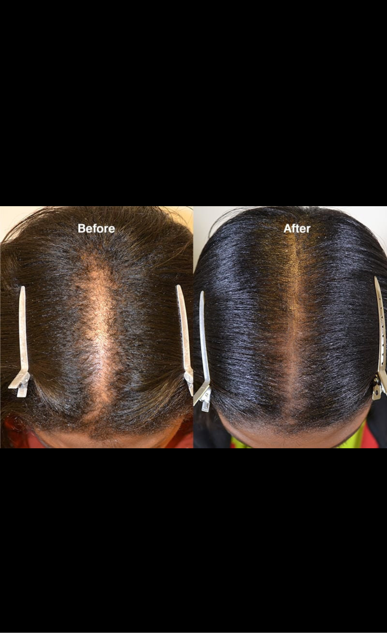 Indian Hair oil